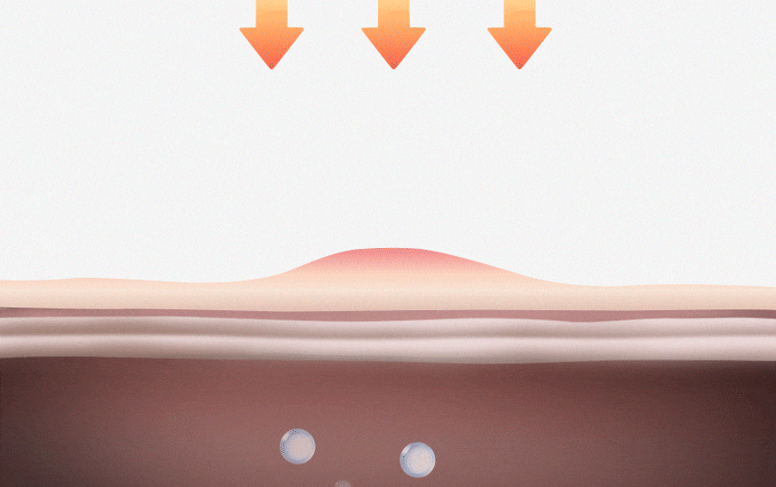 94a5d6614604ce723d1d71dd0b9ceb7e_1741844841_7341.gif