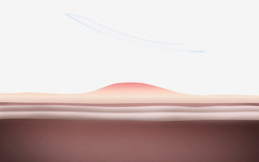 94a5d6614604ce723d1d71dd0b9ceb7e_1741845208_9084.gif
