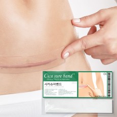 시카슈어밴드 화상 제왕절개 수술 켈로이드 상처 흉터 밴드 15cm X 3cm